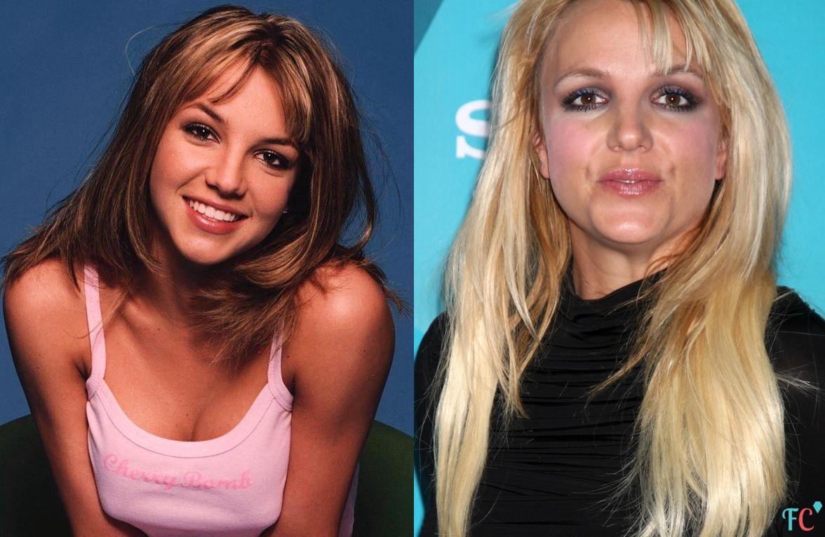 10 star di Hollywood che... stanno invecchiando MALE! articolo