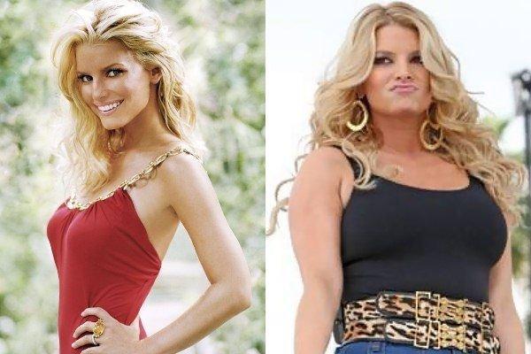 25 Star di Hollywood che sono cambiate... IN PEGGIO! articolo