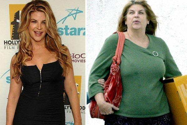 25 Star di Hollywood che sono cambiate... IN PEGGIO! articolo