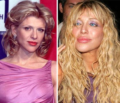 Le star più rifatte di Hollywood: PRIMA e DOPO articolo