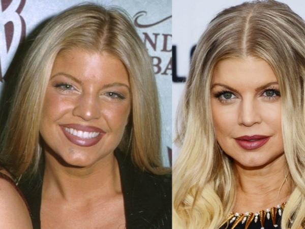 Le star più rifatte di Hollywood: PRIMA e DOPO articolo