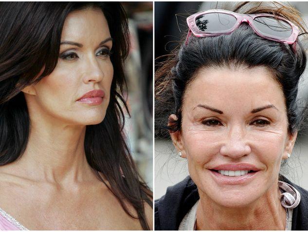 Le star più rifatte di Hollywood: PRIMA e DOPO articolo