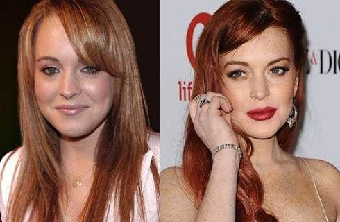 Le star più rifatte di Hollywood: PRIMA e DOPO articolo