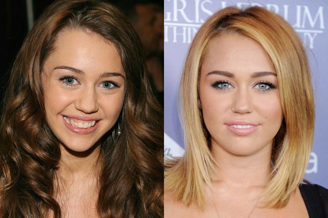 Le star più rifatte di Hollywood: PRIMA e DOPO articolo