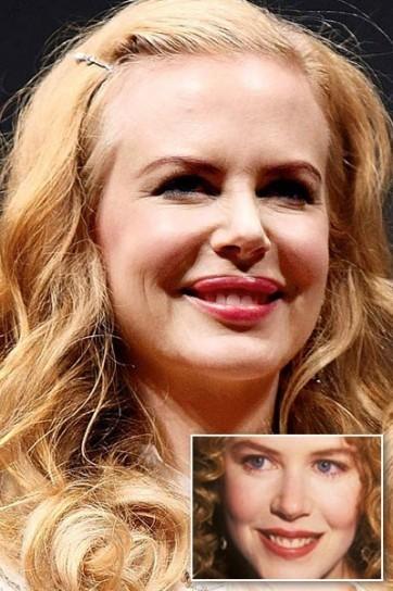 Le star più rifatte di Hollywood: PRIMA e DOPO articolo