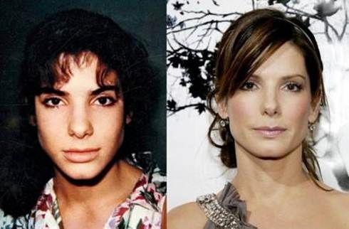 Le star più rifatte di Hollywood: PRIMA e DOPO articolo