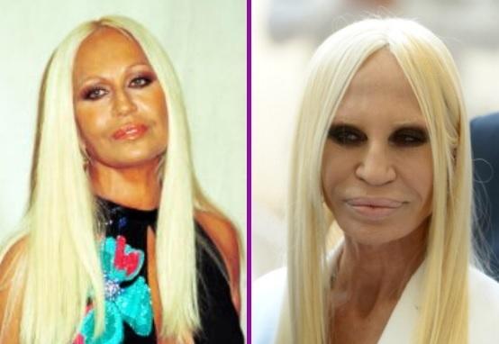 Le star più rifatte di Hollywood: PRIMA e DOPO articolo