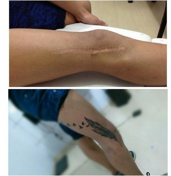 Tatuaggi su cicatrici: i 10 esempi più forti articolo