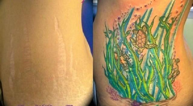 Tatuaggi su cicatrici: i 10 esempi più forti articolo