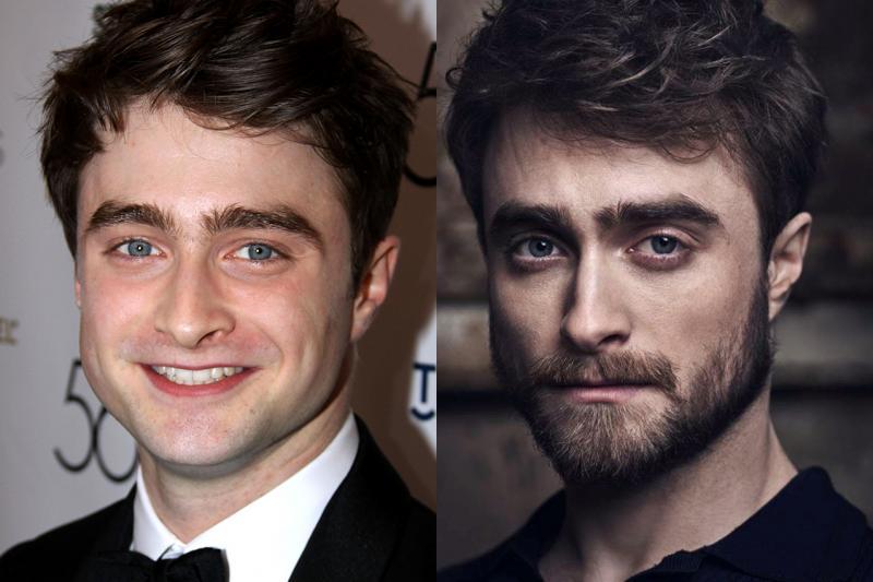 20 Star di Hollywood che sono cambiate tantissimo in soli 5 anni! articolo