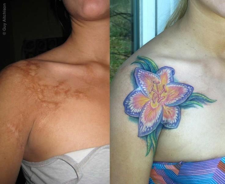 Tatuaggi su cicatrici: i 10 esempi più forti articolo