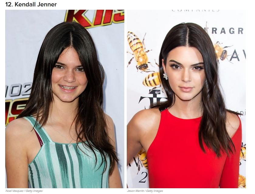 20 Star di Hollywood che sono cambiate tantissimo in soli 5 anni! articolo