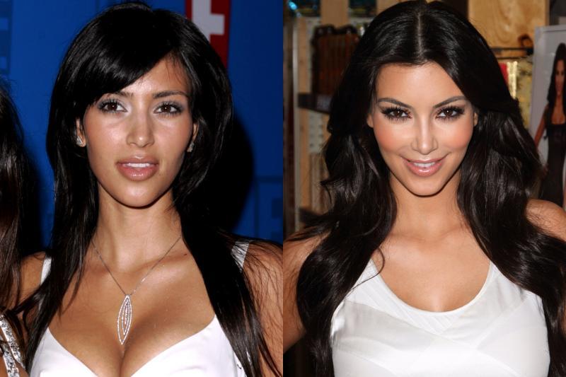20 Star di Hollywood che sono cambiate tantissimo in soli 5 anni! articolo
