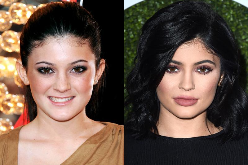 20 Star di Hollywood che sono cambiate tantissimo in soli 5 anni! articolo