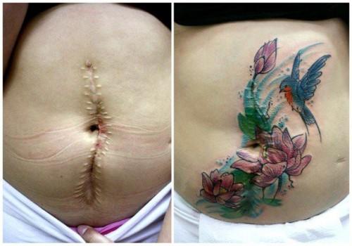 Tatuaggi su cicatrici: i 10 esempi più forti articolo