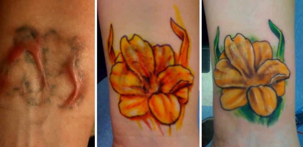 Tatuaggi su cicatrici: i 10 esempi più forti articolo