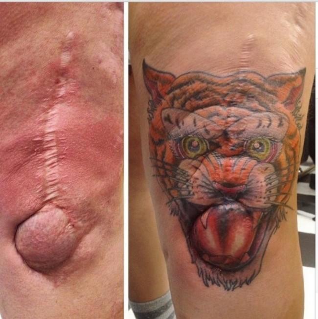 Tatuaggi su cicatrici: i 10 esempi più forti articolo