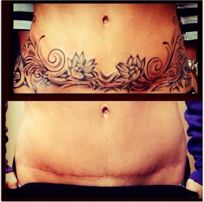 Tatuaggi su cicatrici: i 10 esempi più forti articolo
