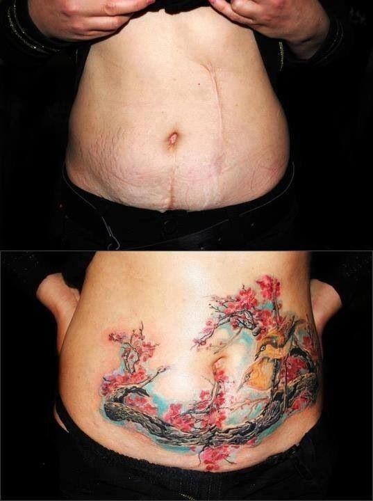 Tatuaggi su cicatrici: i 10 esempi più forti articolo