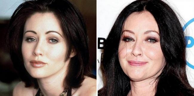 Beverly Hills 25 anni dopo: ecco come sono diventati gli attori articolo