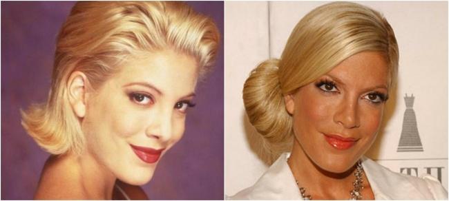 Beverly Hills 25 anni dopo: ecco come sono diventati gli attori articolo