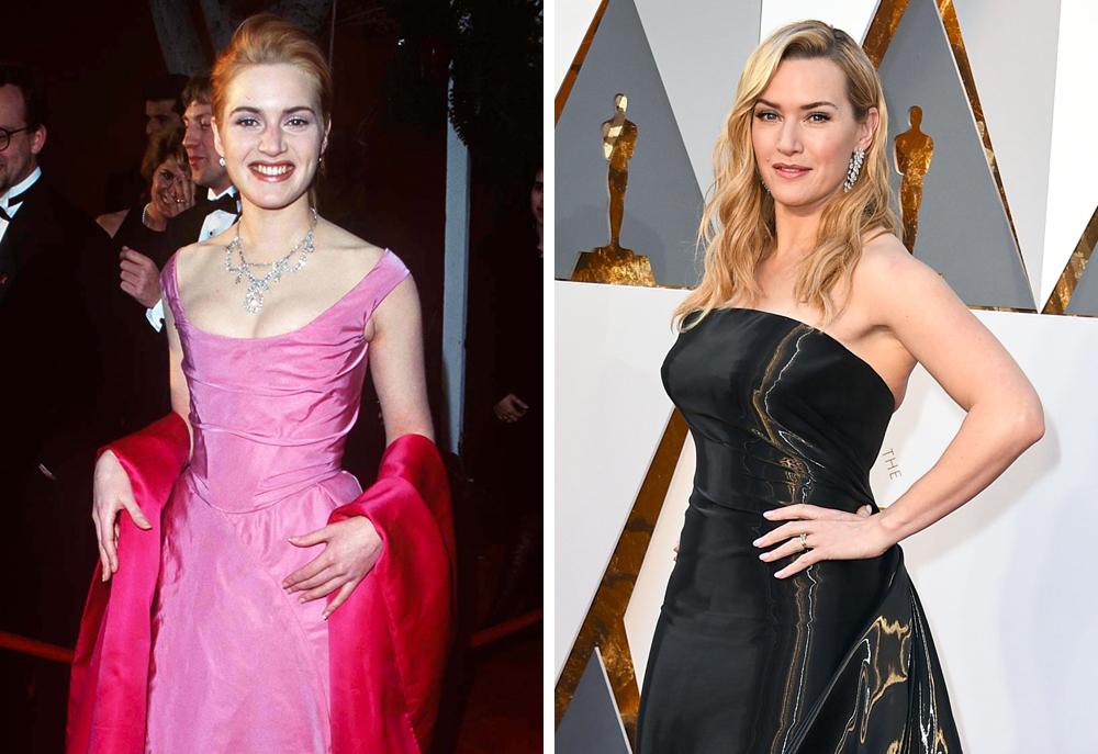 20 Star di Hollywood che sono cambiate molto dal primo Oscar ad oggi! articolo