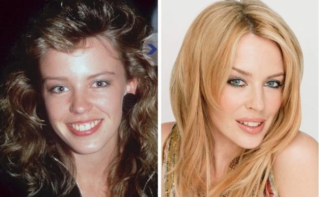 20 foto incredibili delle POP STAR prima che diventassero famose! articolo