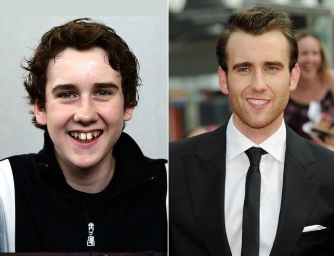 20 ragazzi famosi che sono cresciuti fino a diventare bellezze di Hollywood articolo