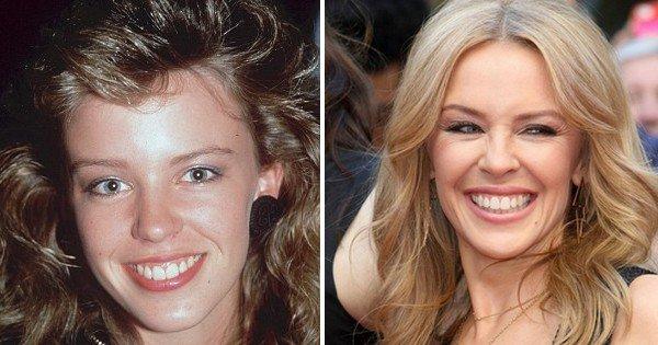 Come sono cambiati i cantanti nel tempo: PRIMA e DOPO! articolo