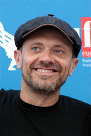 Denti storti prima e dopo: 20 personaggi famosi che hanno 'aggiustato' il loro sorriso! articolo