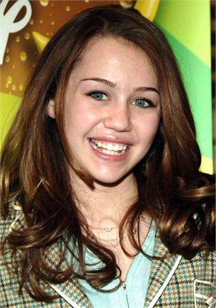 Denti storti prima e dopo: 20 personaggi famosi che hanno 'aggiustato' il loro sorriso! articolo