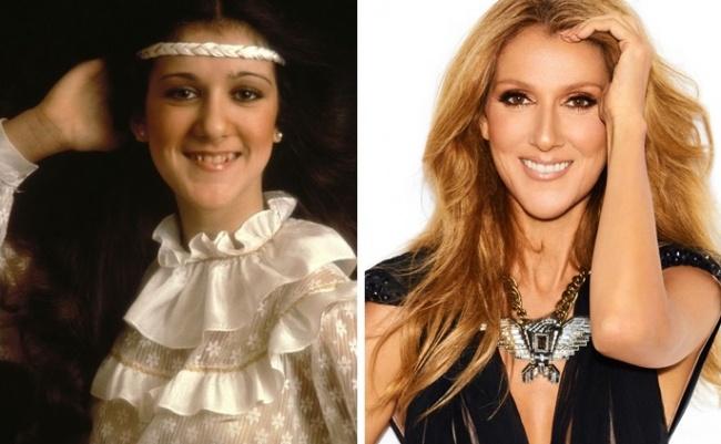 20 celebrities che sono cambiati totalmente una volta diventate famose! articolo