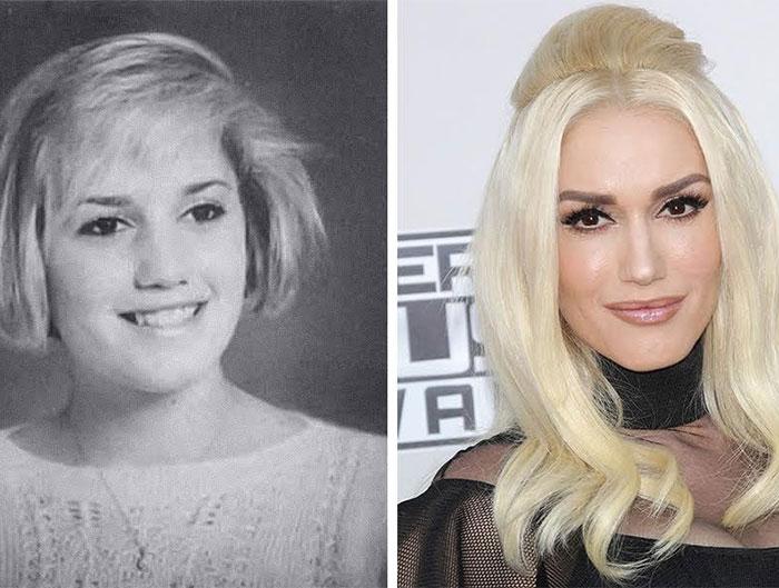 20 celebrities che sono cambiati totalmente una volta diventate famose! articolo