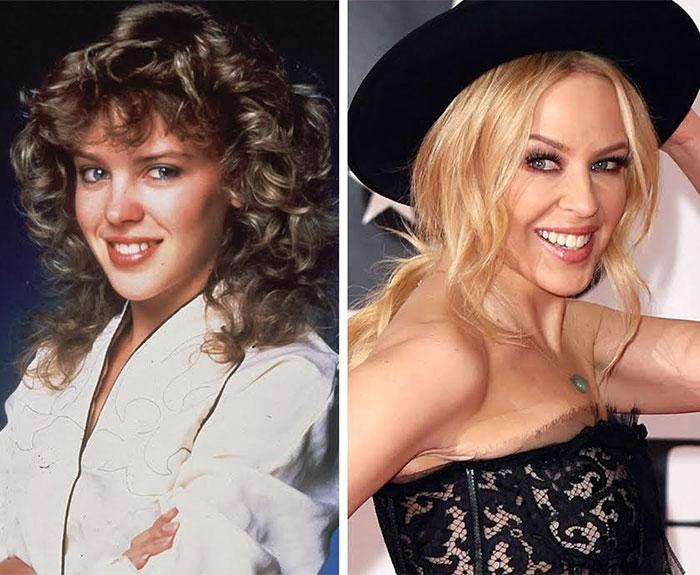 20 celebrities che sono cambiati totalmente una volta diventate famose! articolo