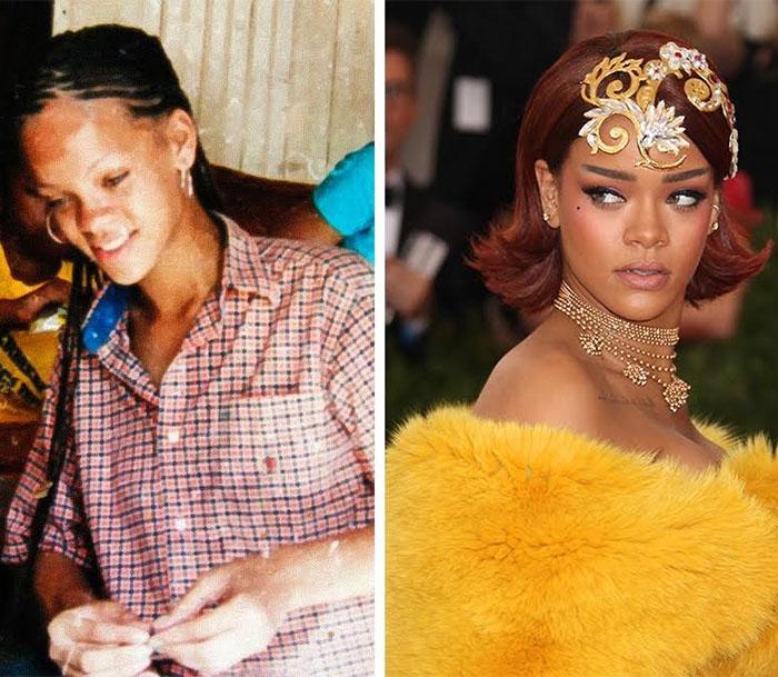 20 celebrities che sono cambiati totalmente una volta diventate famose! articolo