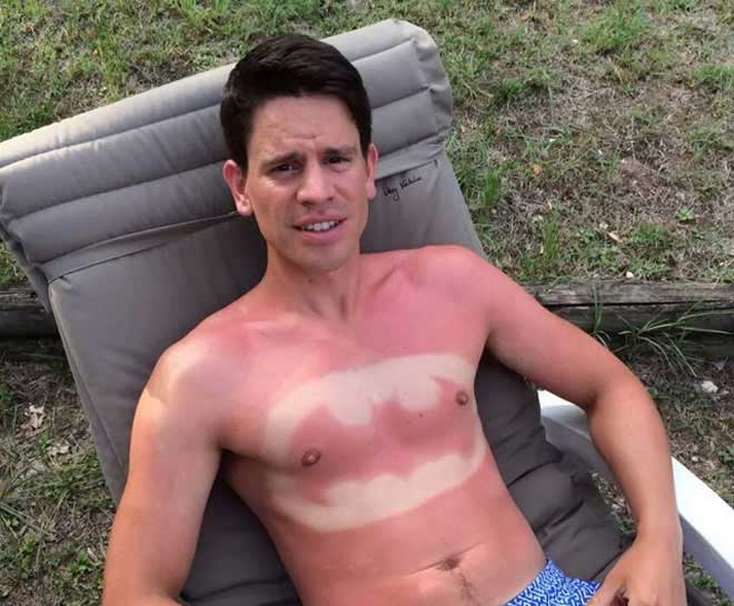  foto di abbronzature assurde batman