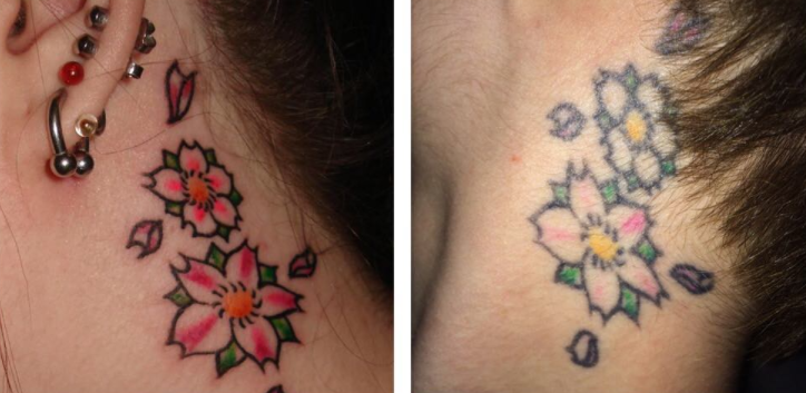 Quando i tatuaggi non passano la prova del tempo articolo