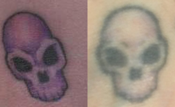 Quando i tatuaggi non passano la prova del tempo articolo