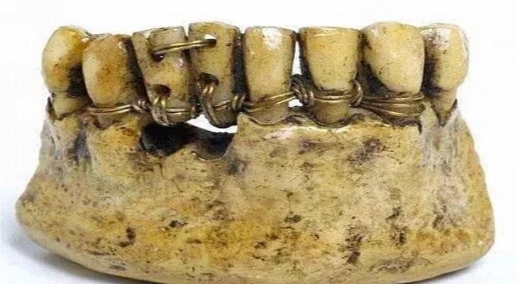 dentiera romana