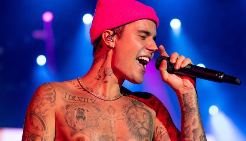 justin bieber sindrome ramsay hunt
