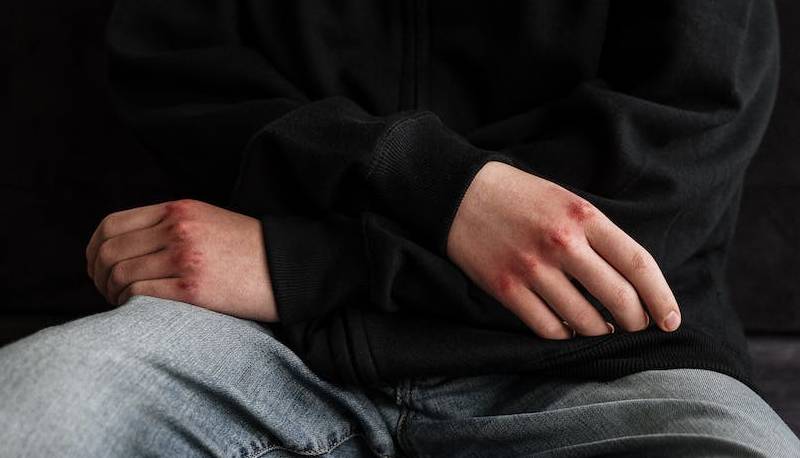 violenza giovani sempre più diffusa