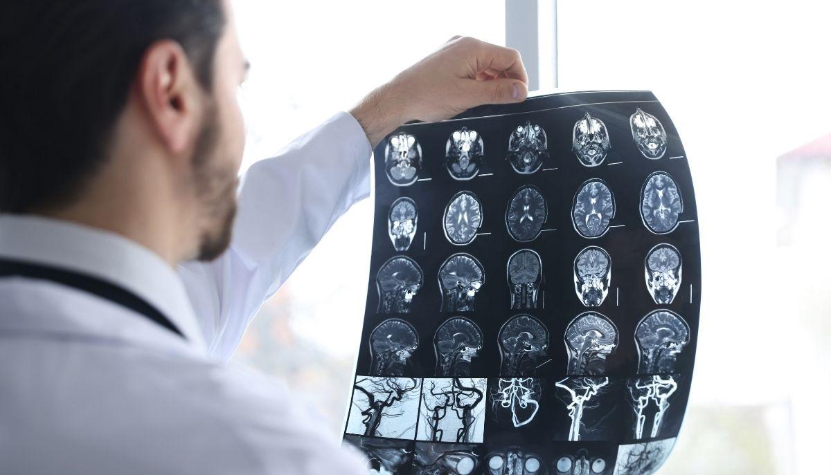 L'adolescenza finisce dopo i 30 anni: lo studio del cervello mostra quando iniziano le 5 'ere' della vita dell'uomo