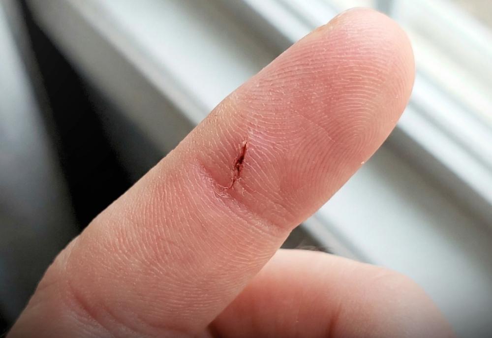 Hai mani e piedi sempre caldi? Il motivo è incredibile e dice tutto sulla tua salute articolo