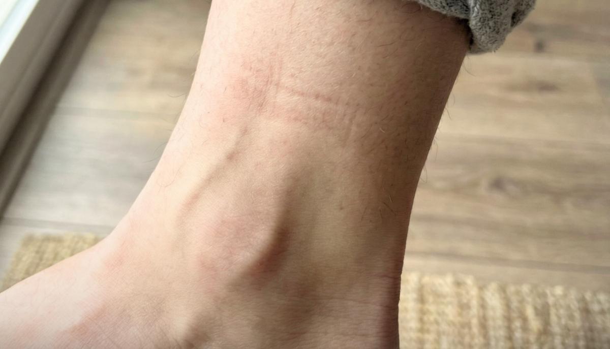 Hai mani e piedi sempre caldi? Il motivo è incredibile e dice tutto sulla tua salute articolo