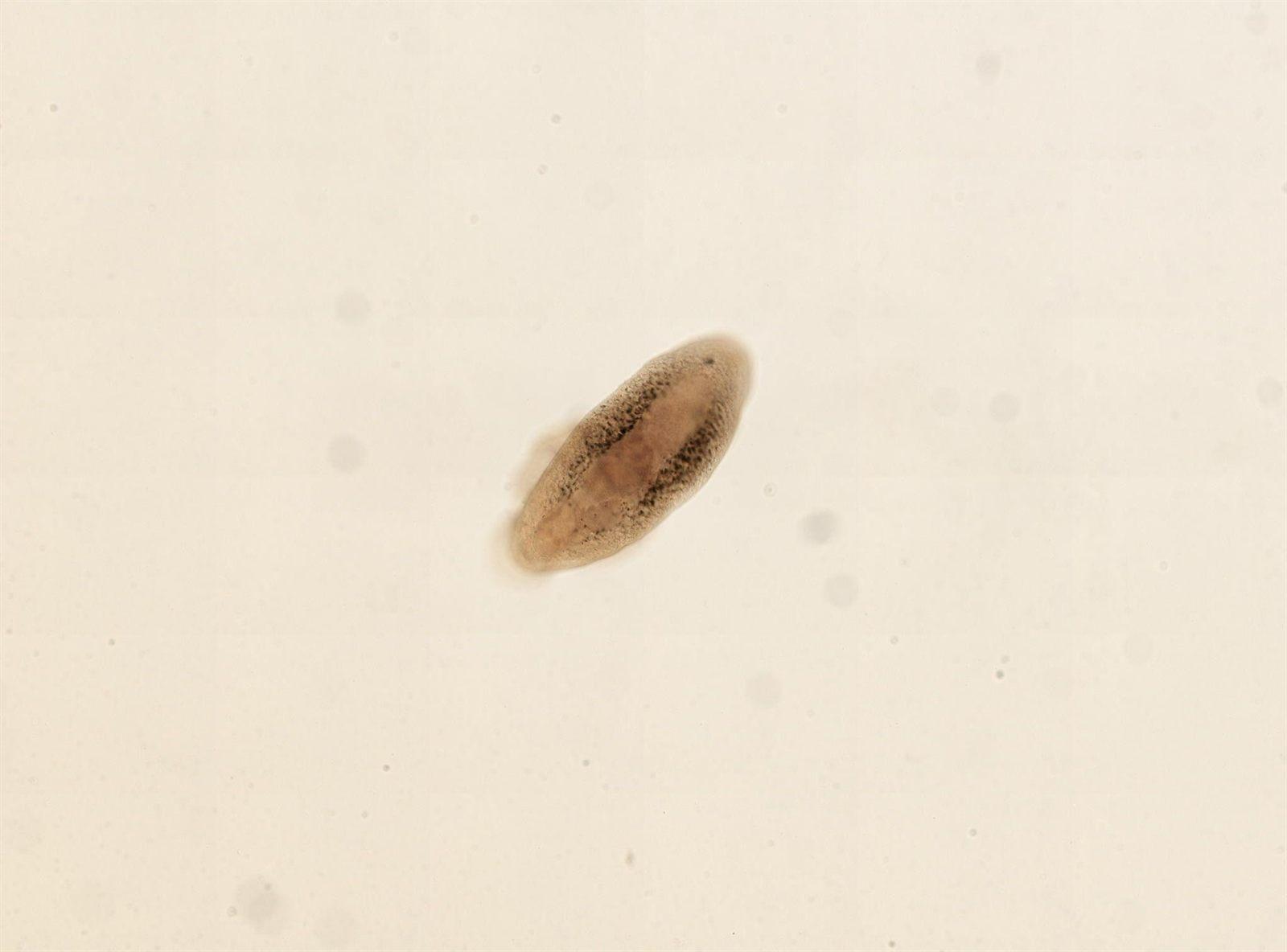 Aspidogaster, verme platelminta della sottoclasse Aspidogastrea