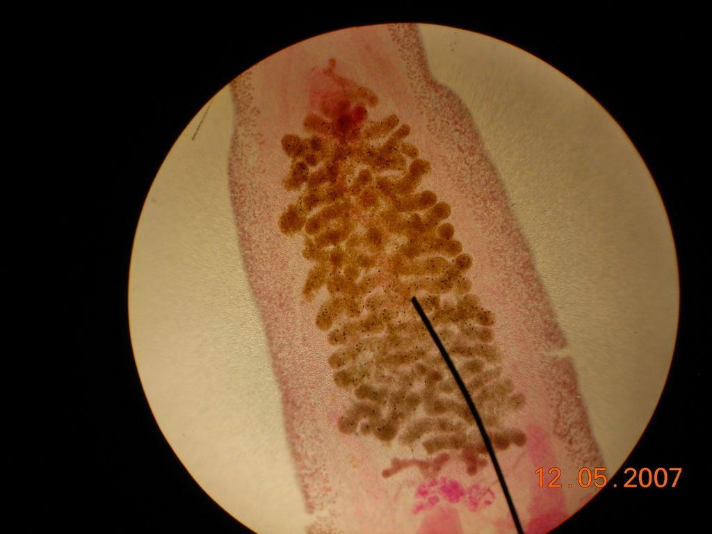 Clonorchis sinensis, trematode parassita del fegato tra i Platelminti