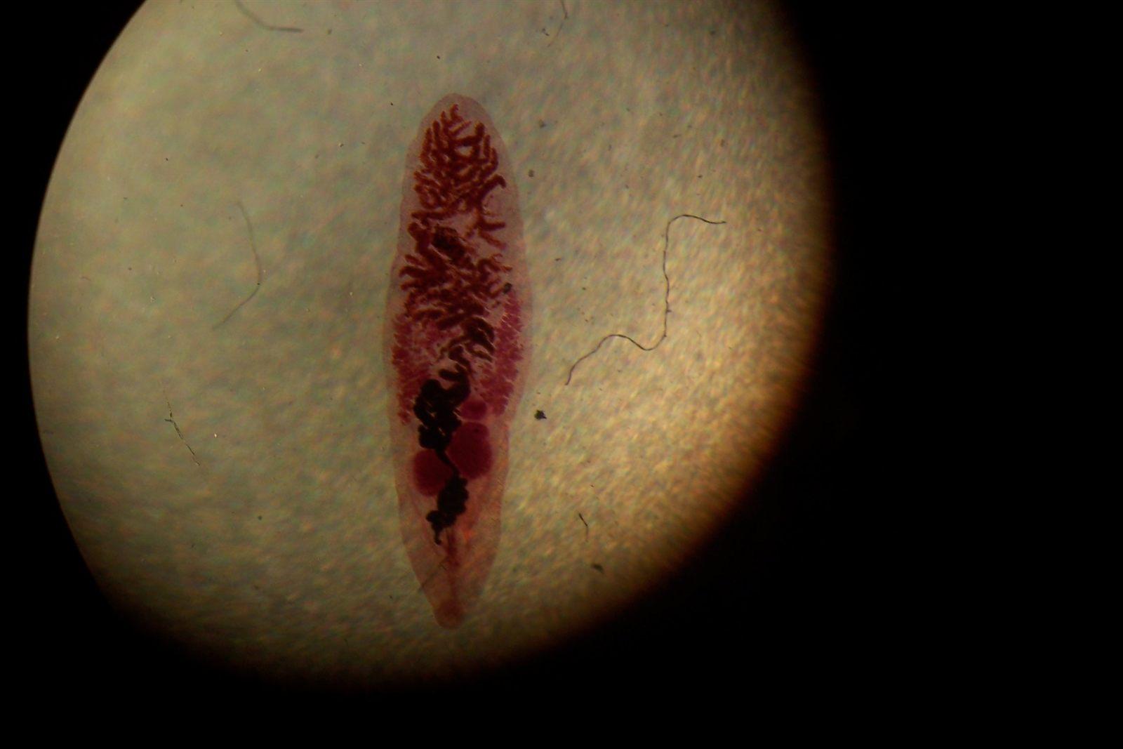 Dicrocoelium dendriticum, trematode digeneo della classe dei Platelminti
