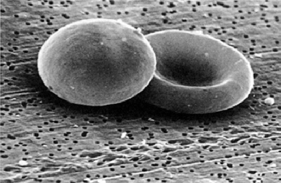 Globuli rossi al microscopio elettronico, componenti del sangue