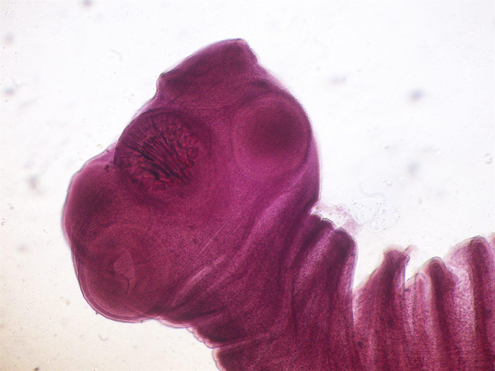 Scolice di Taenia solium con uncini e ventose, cestode del phylum Platelminti