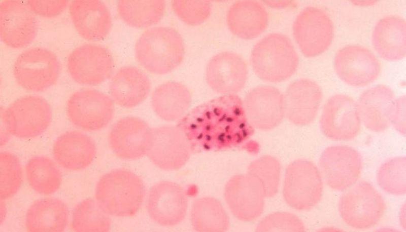 Funzioni e patologie del sistema circolatorio umano articolo